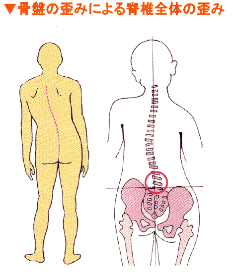 が 高 違う の さ 肩 両肩の高さが違う……左肩が下がる方の特徴と原因