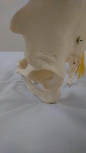 骨盤の歪みと股関節の関係
