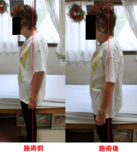 施術前後の写真