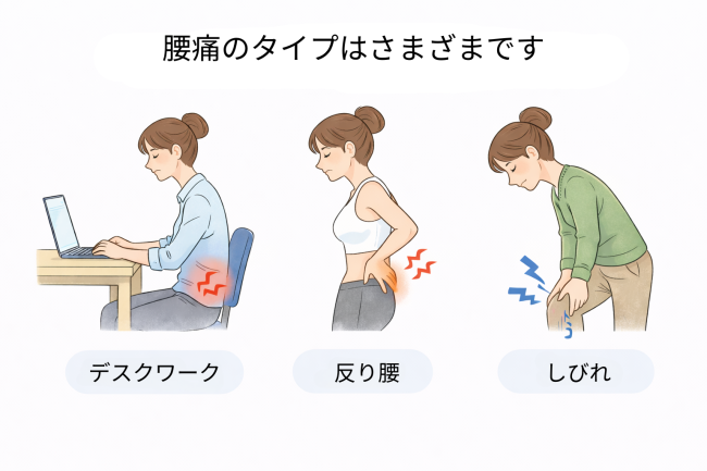 腰痛のタイプ別イラスト(デスクワーク腰痛・反り腰・しびれ)
